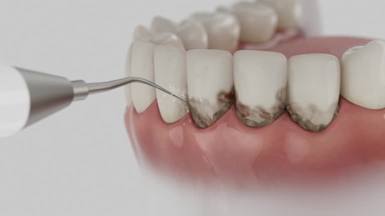 Reliable Dental contractor in Green Springs, OH by Dentist Open Now